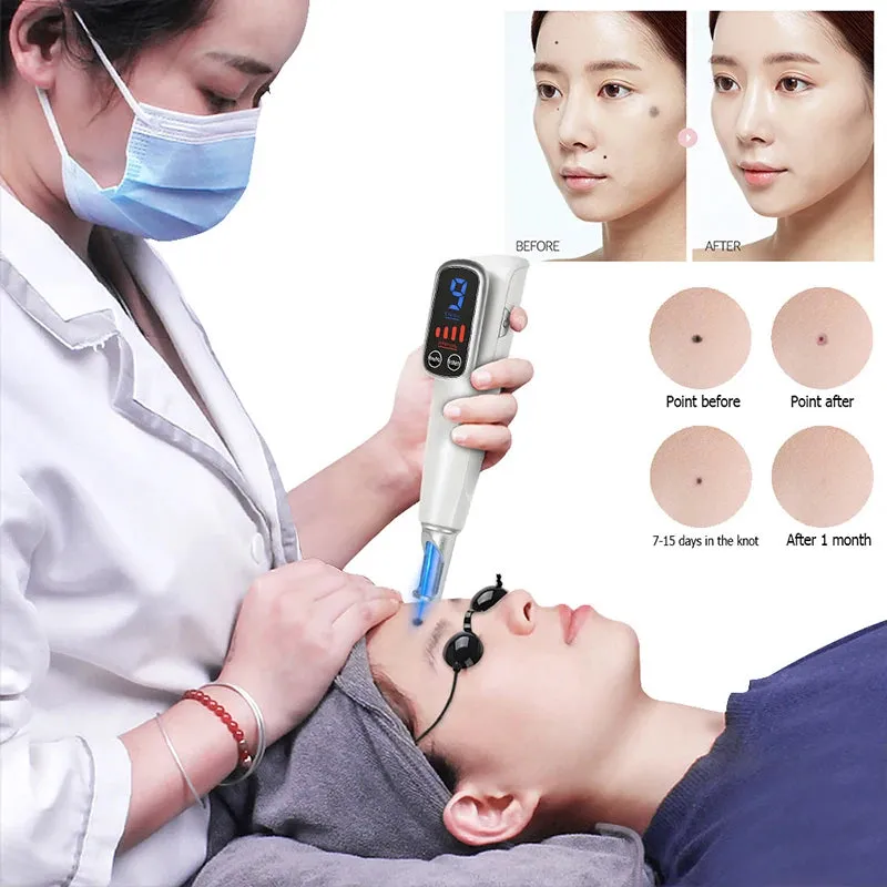 Professional Laser Picosecond Pen Blue Light Therapy Tattoo Remove Freckle Acne Mole Dark Spot Pigment Removal Machine Skin Care